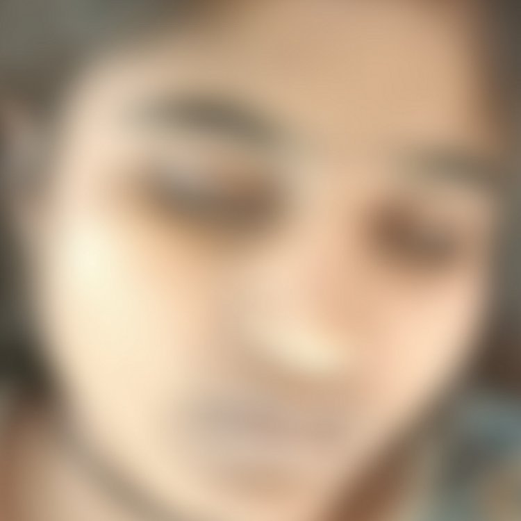 बैतूल में 18 वर्षीय छात्रा ने खाया जहर:अस्पताल ले जाने के बजाय नजर उतारने में लगे परिजन; इलाज में देरी से गई जान