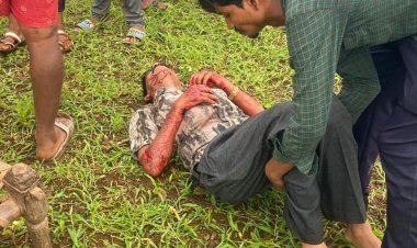 आलीराजपुर में तेंदुए ने दो वन कर्मियों पर किया हमला:एक युवक ने पत्थर मारकर तेंदुए को भगाया, तब बची दोनों की जान