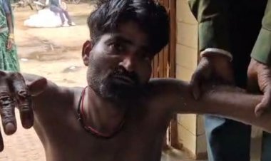 पत्नी मायके गई तो गुस्साए पति ने गुप्तांग काट लिया:दमोह के मड़ियादो इलाके की घटना, घायल जिला अस्पताल रेफर